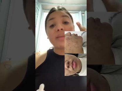 Sérum Niacinamida 10% E Se? Cosméticos — controla oleosidade, equilibra e uniformiza o tom da pele 30ml